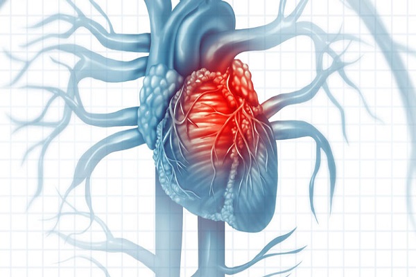 Kiểm tra sức khỏe tim mạch bằng thăm dò ECG